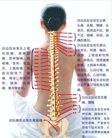 保護(hù)腰椎—示范腰椎保健操，趕快收藏吧