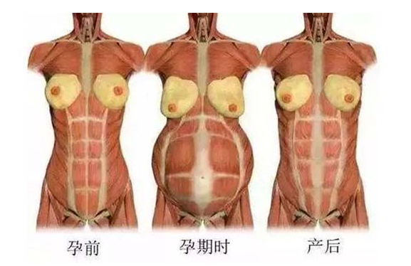 產(chǎn)后媽媽骨盆修復(fù)――帶你回到完美身材！