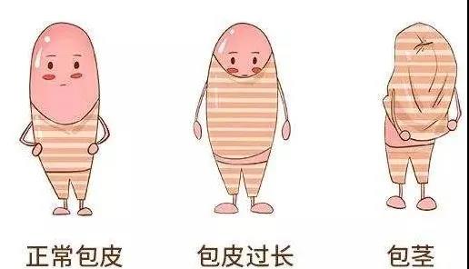 【保山安利醫(yī)院】家長速看！暑期包皮手術(shù)預(yù)約正當時！