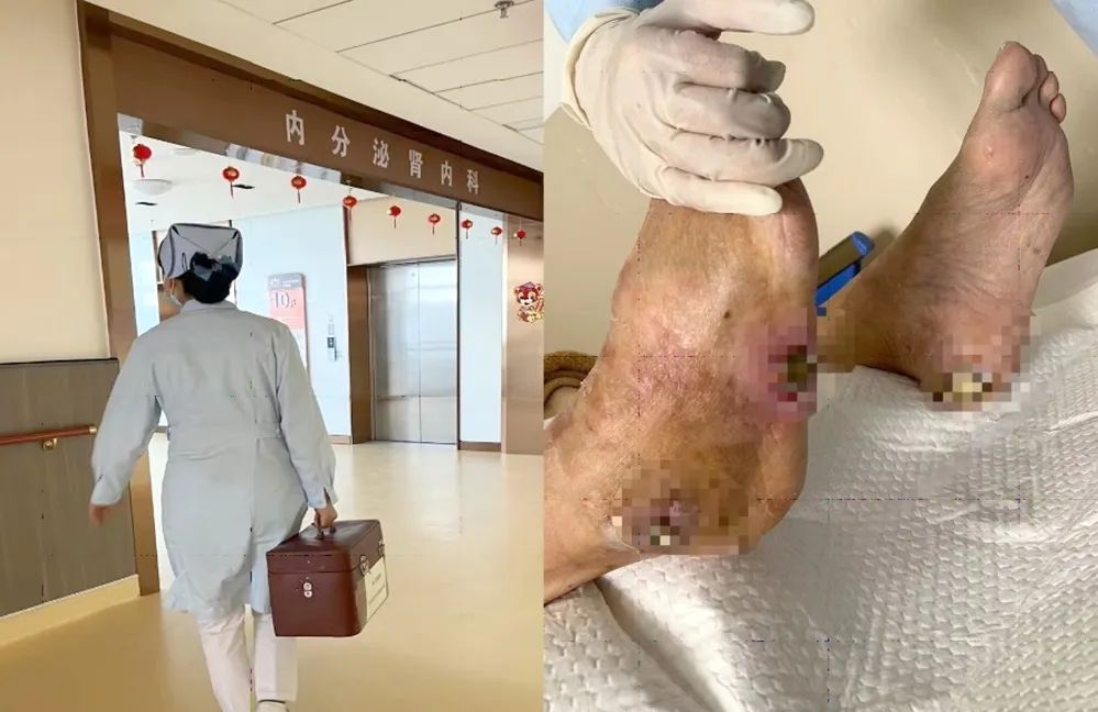【保山安利醫(yī)院】傷口治療一站式，健康生活零距離！